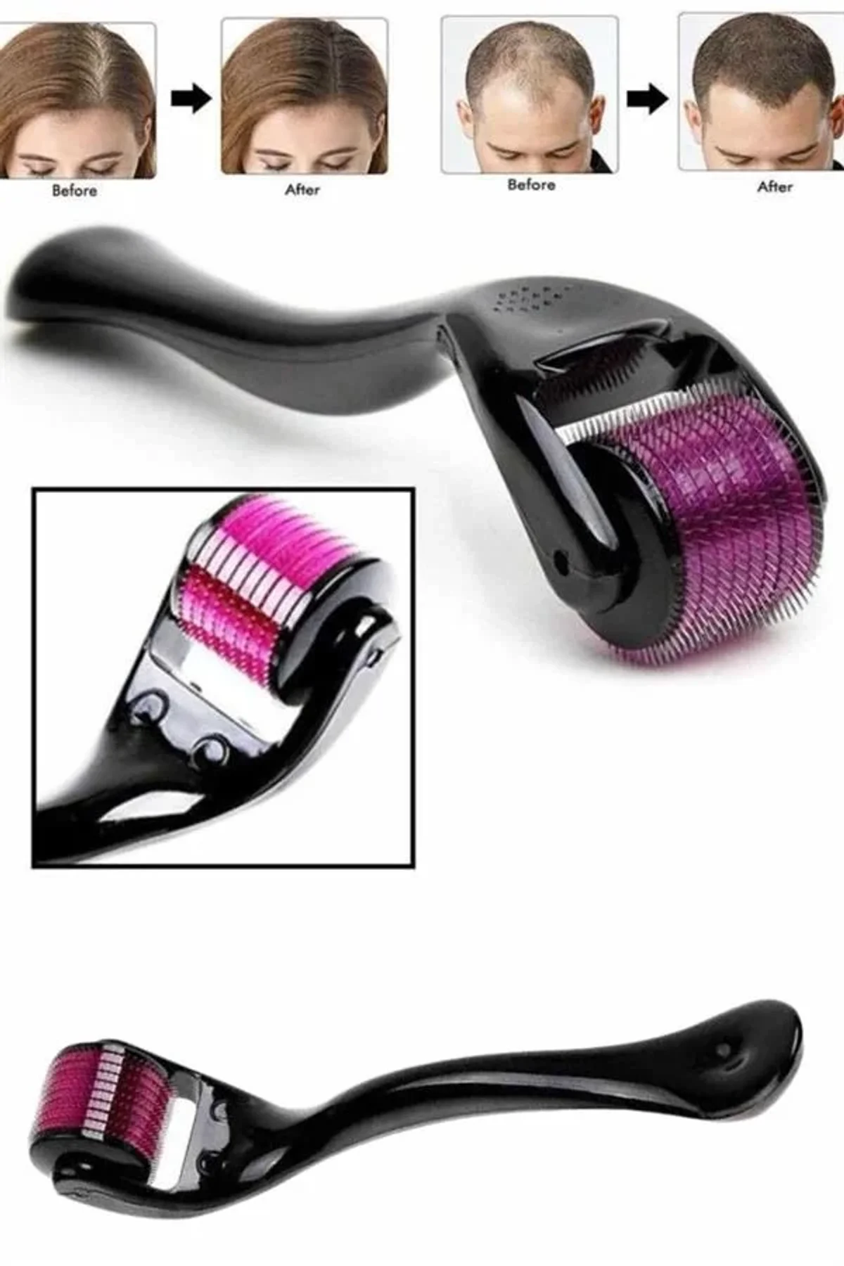 Derma Roller Titanyum Uçlu 540 İğneli 1 Mm Saç Sakal Çıkarma Ve Cilt Bakım Masaj Aleti - Just Cheap Store Görsel 2