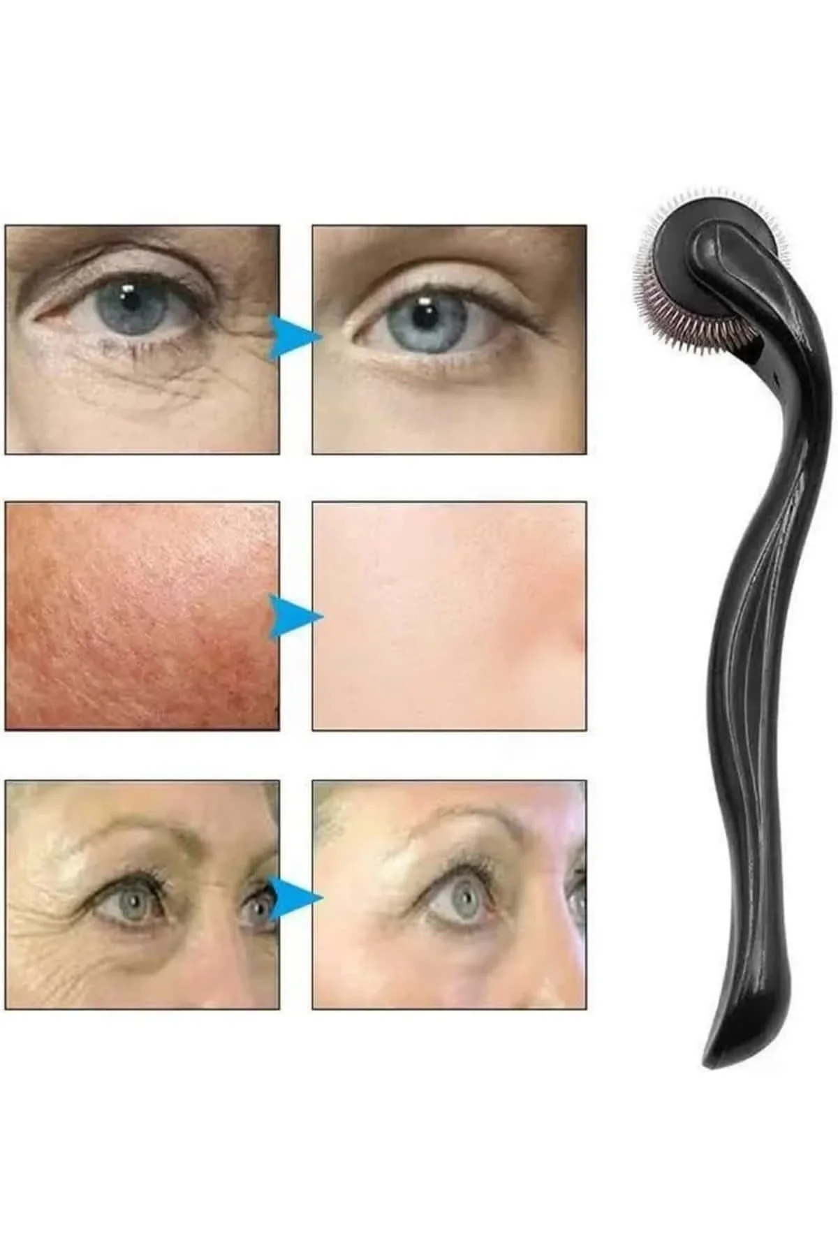 Dermaroller Titanyum 540 Iğneli 1 Mm Saç Kaş Sakal Serum Kullanıma Uygun - Just Cheap Store Görsel 4