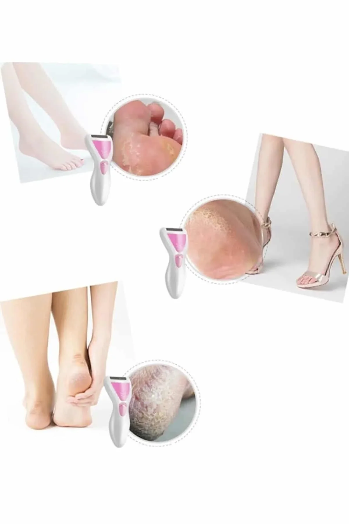 Epilatör Cihazı Epilasyon Aleti Çoklu Başlık Seçeneği Ayak Törpüsü - Just Cheap Store Görsel 3