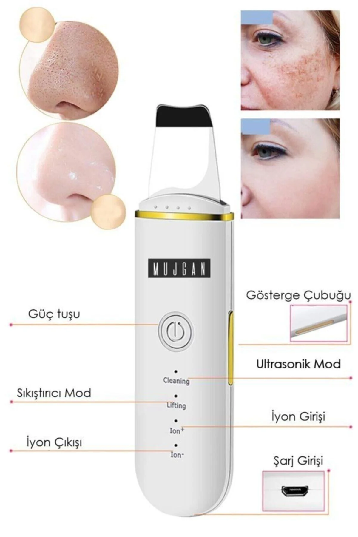 Ultrasonic Scubber Siyah Nokta Akne Gidereci Yüz Spatulası Ölü Deri Temizleme - pazariz Görsel 4