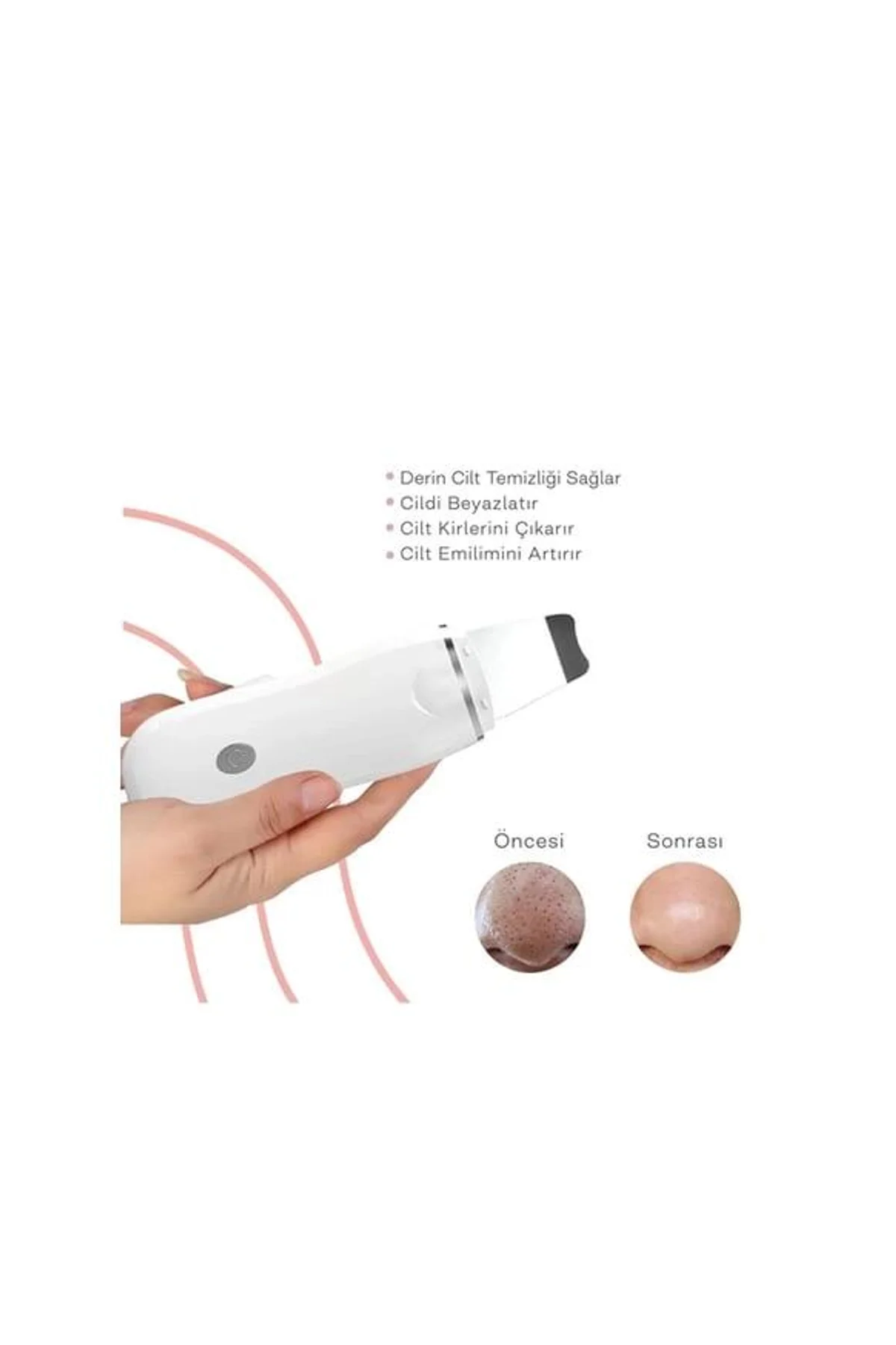 Ultrasonik Spatula Yüz Akne Giderici Siyah Nokta Temizleme Cihazı - Just Cheap Store Görsel 4