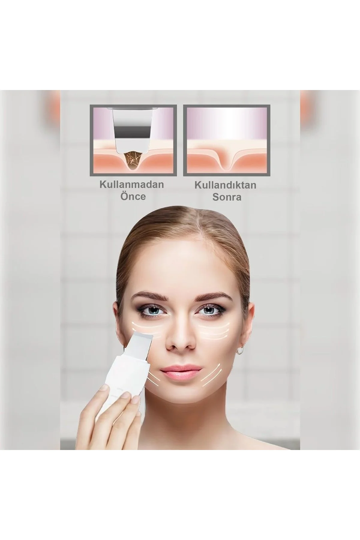 Ultrasonıc Siyah Nokta Akne Spatula Şarjlı Cilt Temizleyici - Just Cheap Store Görsel 2