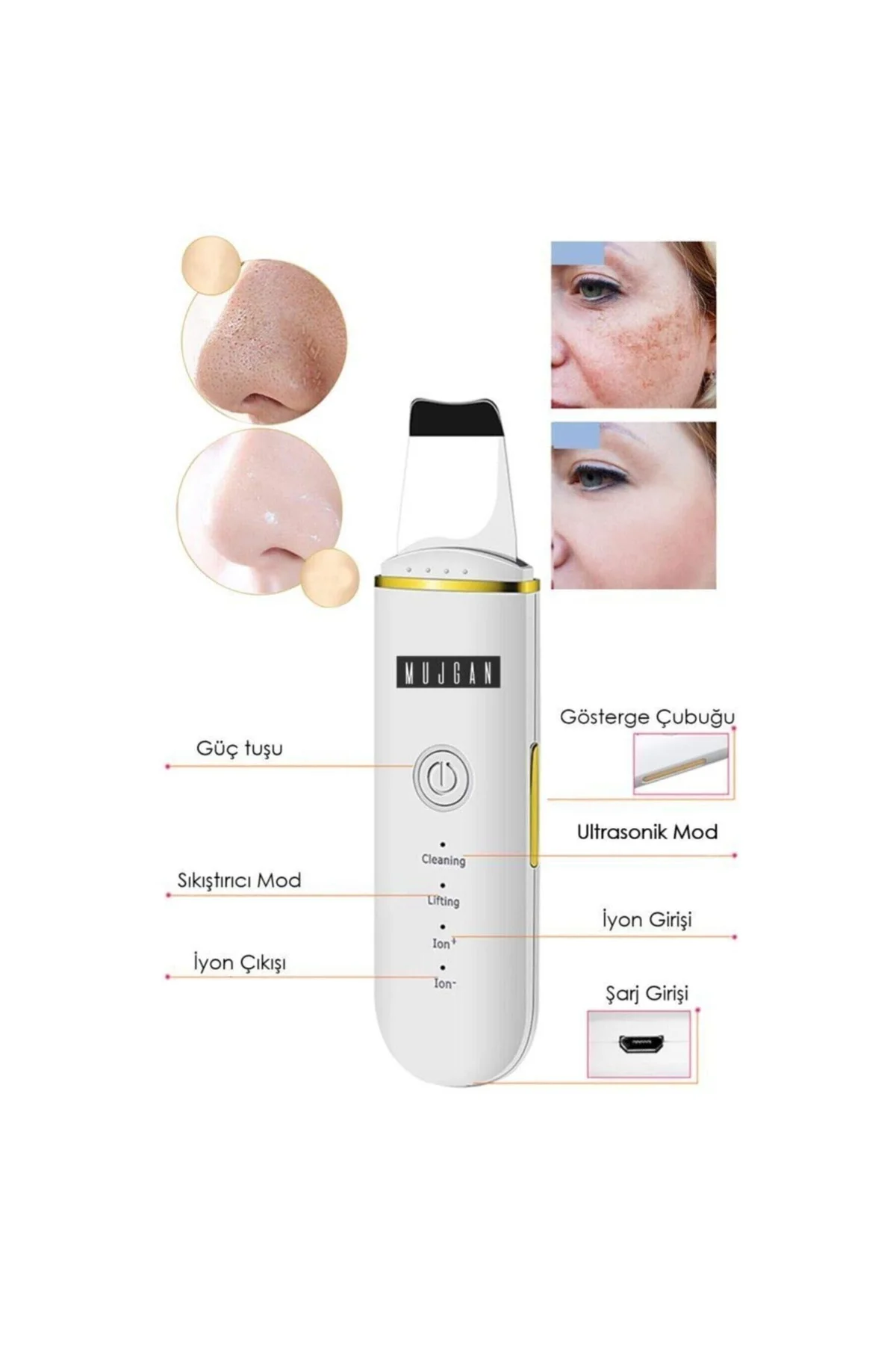 Ultrasonic Scubber Siyah Nokta Akne Gidereci Yüz Spatulası Ölü Deri Temizleme - PAZARIZ Görsel 4