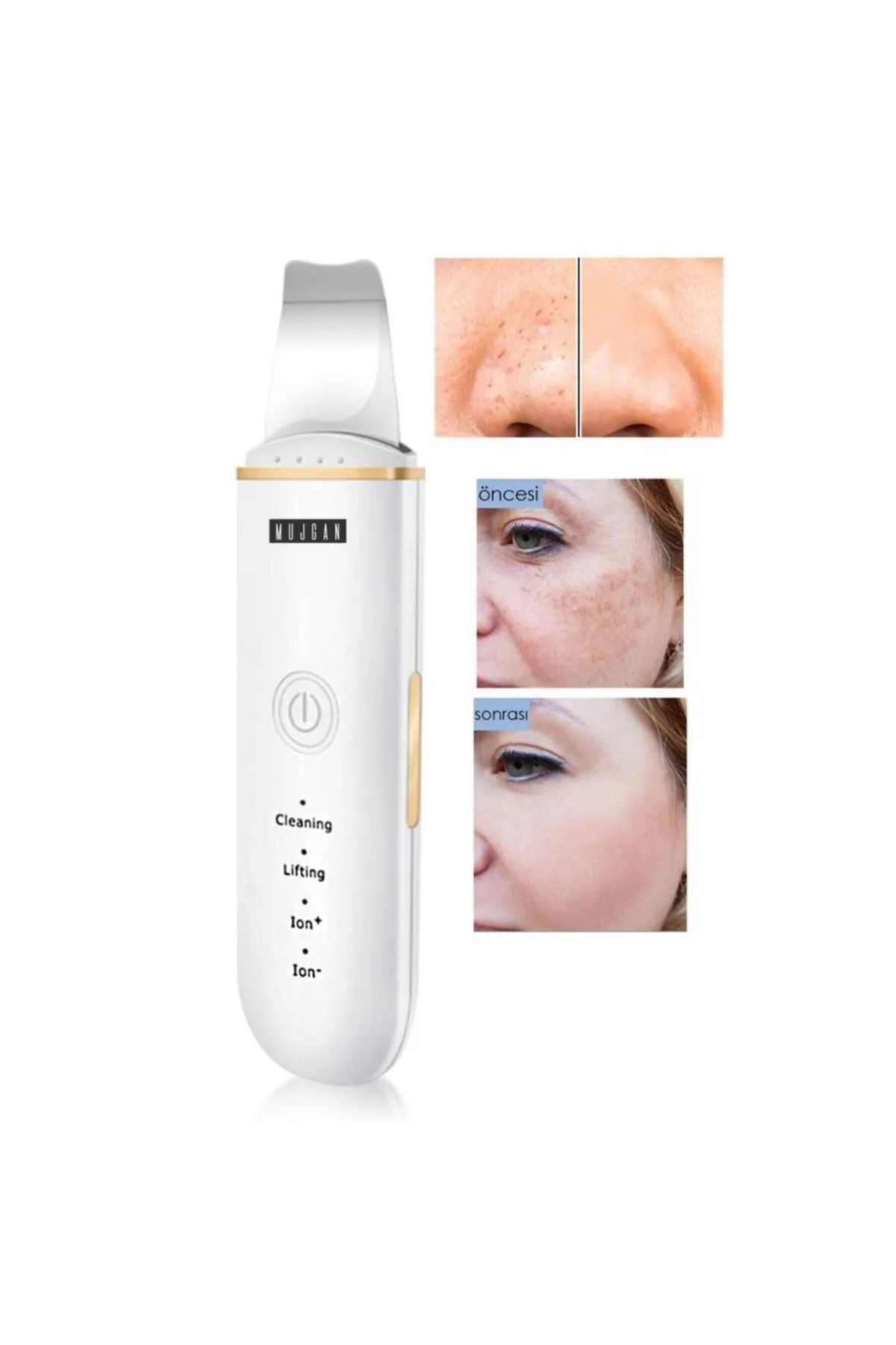 Ultrasonic Scubber Siyah Nokta Akne Gidereci Yüz Spatulası Ölü Deri Temizleme - PAZARIZ Görsel 2