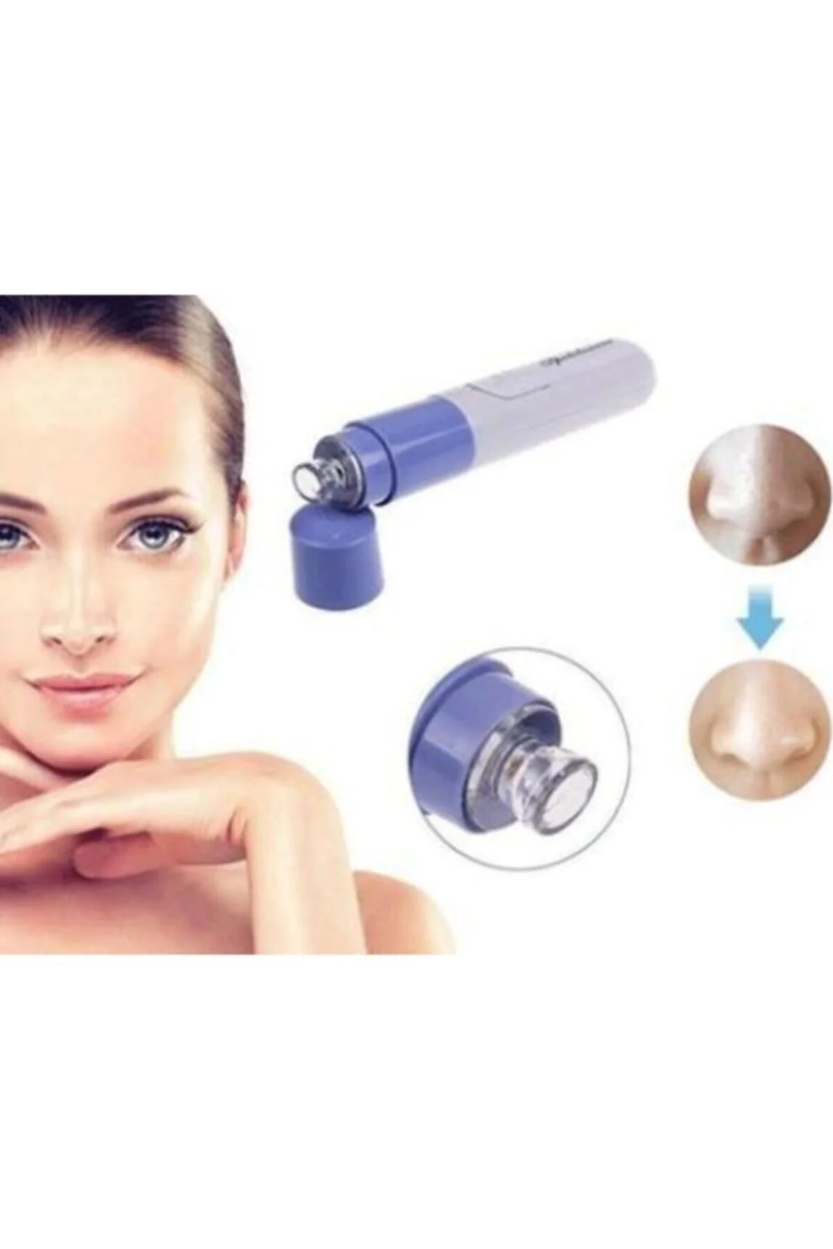 Pore Cleaner Yüz Temizleme Cihazı Vakumlu Siyah Nokta Temizleme Cihazı - pazariz Görsel 3