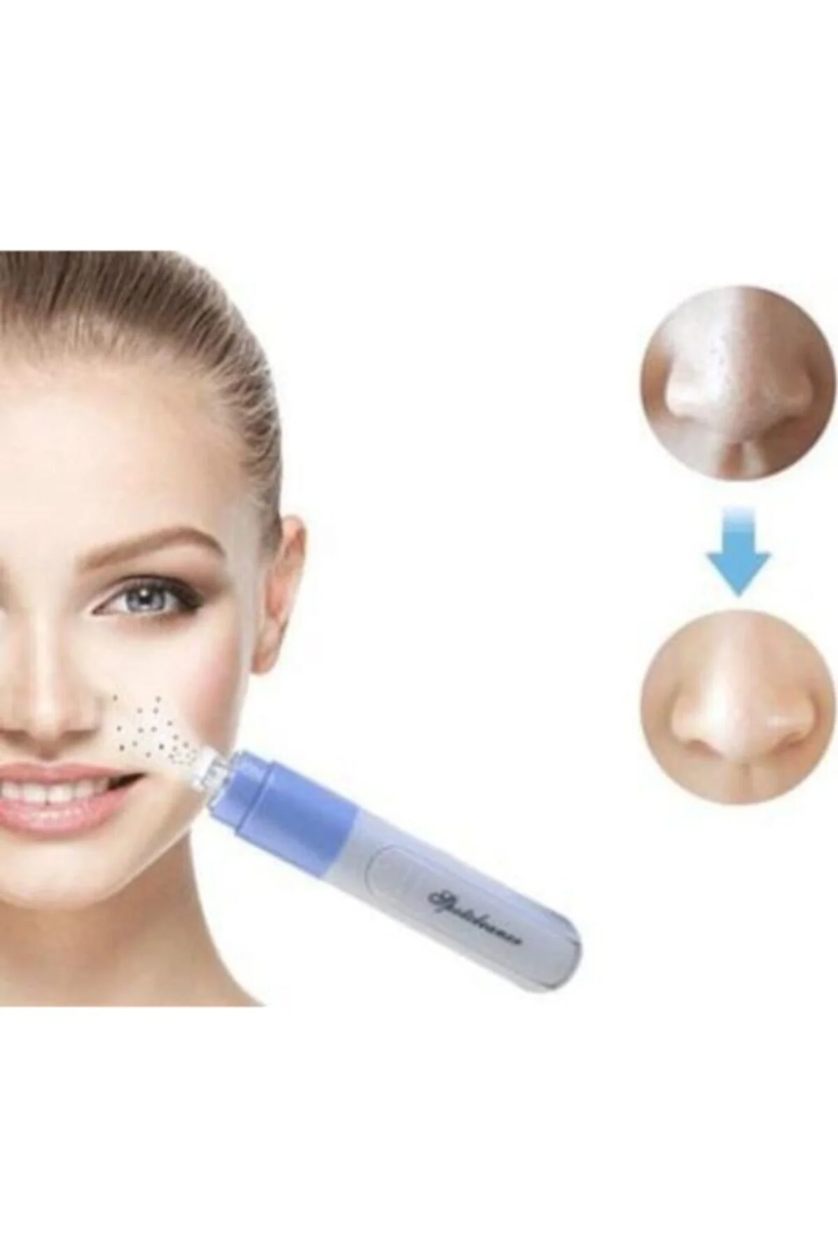 Pore Cleaner Yüz Temizleme Cihazı Vakumlu Siyah Nokta Temizleme Cihazı - pazariz Görsel 2